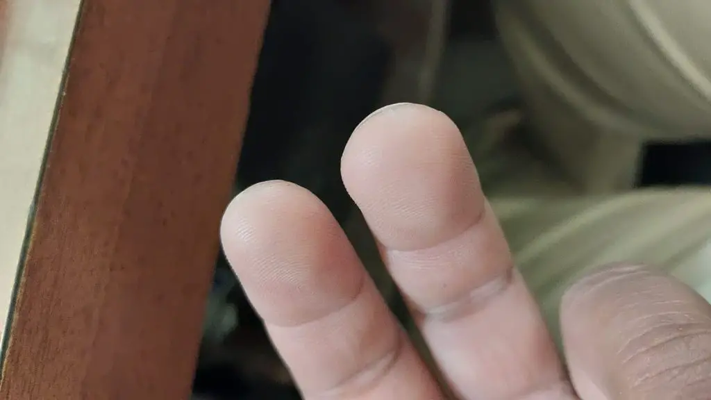How and Why Does Ukulele Cause Calluses